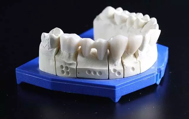 Protezy zębowe – sposób na przywrócenie pełnego uśmiechu